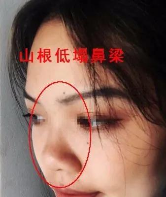 塌鼻子面相算命图解 看女人五官面相运势图解