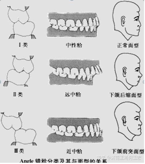 牙齿与面相的关系 牙齿不好，对人面相的影响有多大？|济南口腔