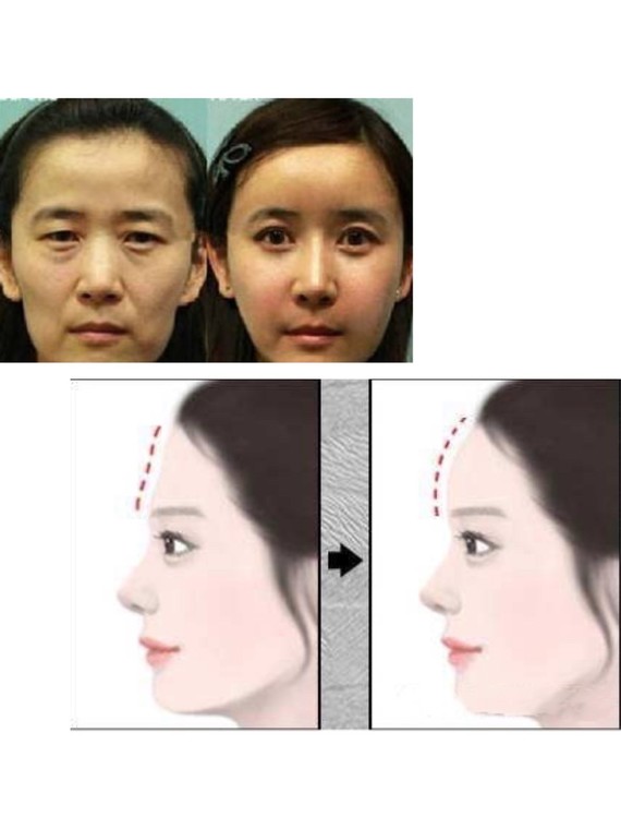 额头饱满地阁方圆的女人面相是什么样子的_额头宽阔饱满天灵盖很明显面相_男人额头饱满面相