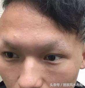 六岁男孩胸中间骨头凸起偶尔会疼_眉毛中间骨头凸起面相_胸口中间疼痛骨头凸起