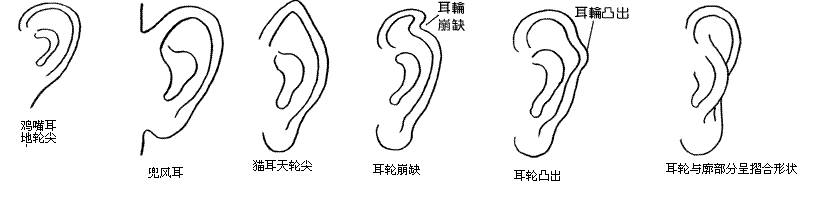 面相 招风耳朵_耳朵大 面相_男人面相之耳朵图解