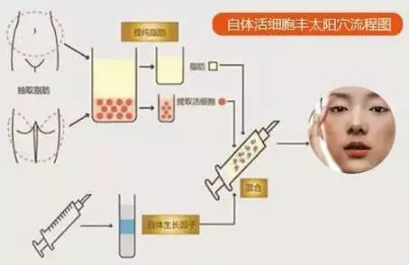 额头中凹陷面相_女生额头凹陷面相_额头凹陷面相