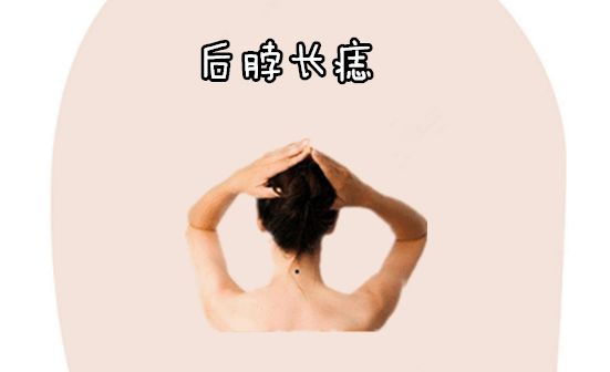 左脖子有痣的男人面相_脸和脖子一样粗的男人面相_男人左眼大右眼小面相