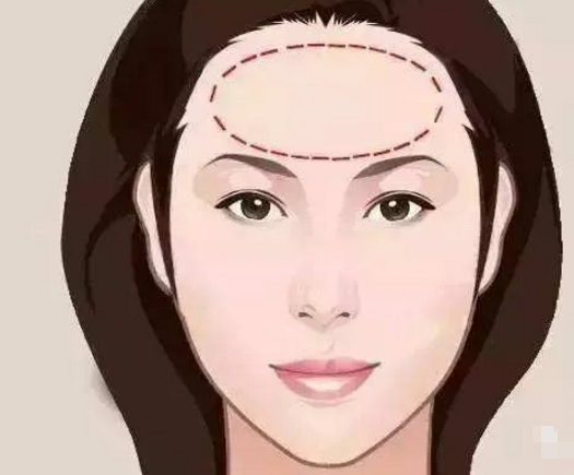 额头有伤疤的面相_额头上有伤疤的面相_额头有伤疤代表什么